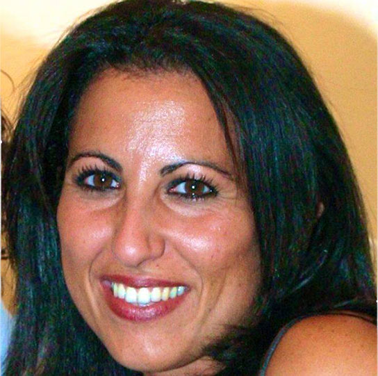 Cosmesi dentale e conservativa Roma San Giovanni