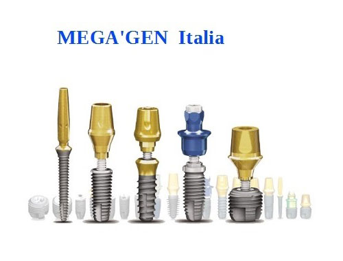 Implantologia dentale Roma